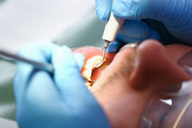 Best Broken or Cracked Tooth Emergency Dentist in Darlington, SC