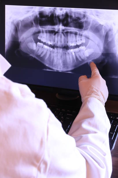 Best Emergency Dental Extractions in Darlington, SC